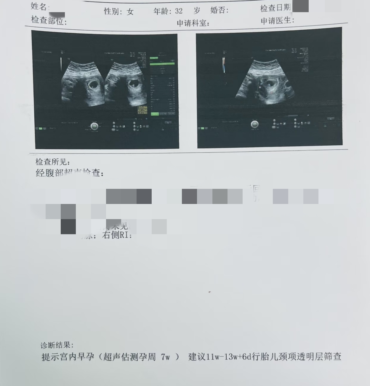 酷爱被无套的少妇玩多人，却意外有了野种[23P]